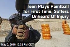 Teen Plays Paintball for First Time, Suffers Unheard Of Injury