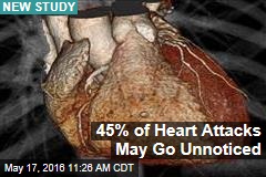 45% of Heart Attacks May Go Unnoticed