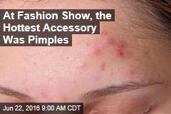 At Fashion Show, the Hottest Accessory Was Pimples