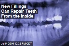 New Fillings Can Repair Teeth From the Inside