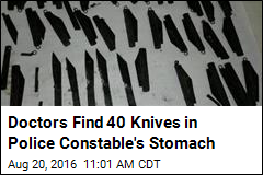 Doctors Find 40 Knives in Police Man&#39;s Stomach