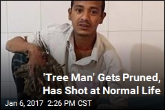 &#39;Tree Man&#39; Gets Pruned, Has Shot at Normal Life
