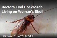 Cockroach Climbs Up Woman&#39;s Nose, Hangs Out on Her Skull