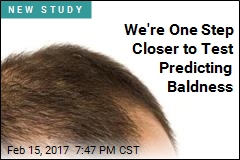 Genetic Test Could Predict Your Risk of Going Bald