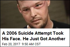 A 2006 Suicide Attempt Took His Face. He Just Got Another