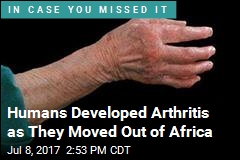 Arthritis Is the Byproduct of Adapting to Cold Climates