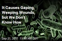It Causes Gaping, Weeping Wounds, but We Don&#39;t Know How