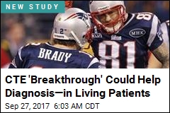 CTE &#39;Breakthrough&#39; Could Help Diagnosis&mdash;in Living Patients
