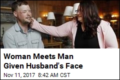 Woman Meets Man Given Husband&#39;s Face
