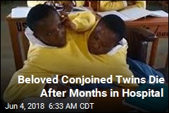 Beloved Tanzanian Conjoined Twins Dead at 21
