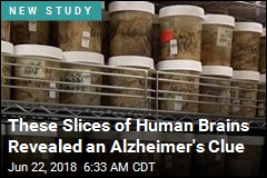 These Slices of Human Brains Revealed an Alzheimer&#39;s Clue