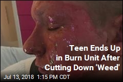 Teen Cuts a &#39;Weed,&#39; Ends Up in Burn Unit