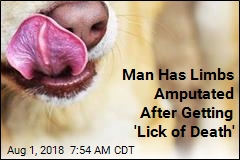 Wis. Man May Have Lost Limbs Over a Dog Lick
