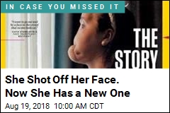 She Shot Off Her Face. Now She Has a New One