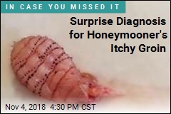 Surprise Diagnosis for Honeymooner&#39;s Itchy Groin