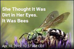 Found, Alive, in Woman&#39;s Eye: 4 Bees