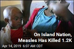 On Island Nation, Measles Has Killed 1.2K