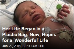 Her Life Began in a Plastic Bag. Now, Hopes for a &#39;Wonderful&#39; Life
