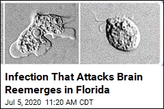 Florida Reports New Case of Brain-Destroying Amoeba