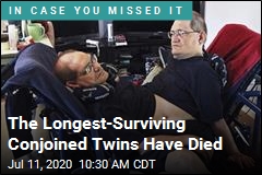 Conjoined Twins Who Lived to Noteworthy Age Have Died