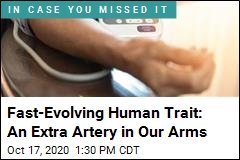 You Might Have an Extra Artery in Your Arm