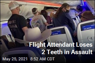 Flight Attendant Loses 2 Teeth in Assault