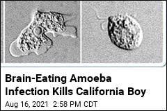 Boy, 7, Dies From Extremely Rare Brain-Eating Amoeba