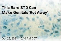 This Rare STD Can Make Genitals &#39;Rot Away&#39;
