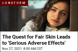 The Quest for Fair Skin Is Driving Dangerous Behavior