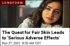The Quest for Fair Skin Is Driving Dangerous Behavior