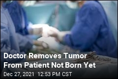 Doctor Removes Tumor From Patient Not Born Yet