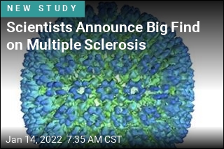Scientists Announce Big Find on Multiple Sclerosis