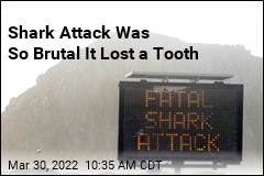 Shark Attack Was So Brutal It Lost a Tooth