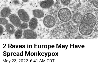 Florida Has First Suspected Case of Monkeypox