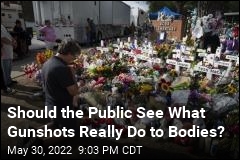 Should the Public See What Gunshots Really Do to Bodies?