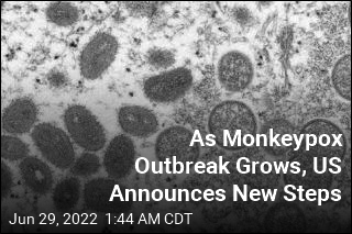 As Monkeypox Outbreak Grows, US Announces New Steps