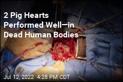 Pig Hearts Performed Well&mdash;in Dead Human Bodies