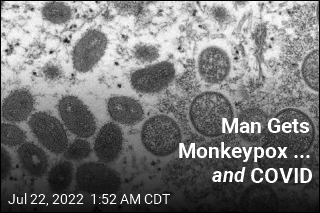 Guy Gets Monkeypox... and COVID