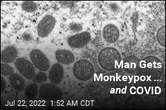 Guy Gets Monkeypox... and COVID