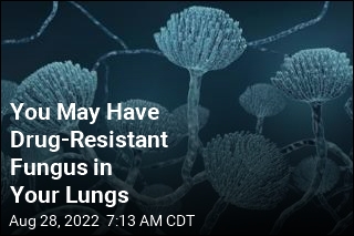 You May Have Drug-Resistant Fungus in Your Lungs