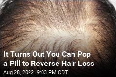 Pop a Pill to Reverse Hair Loss? That Drug Already Exists