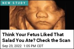 Fetuses&#39; Faces Offer Clues on What Foods They Like