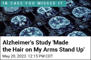 Man&#39;s Brain Mutation Suggests a Way to Treat Alzheimer&#39;s