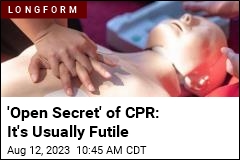 &#39;Open Secret&#39; of CPR: It&#39;s Usually Futile, Violent