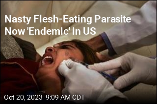 Nasty Flesh-Eating Parasite Now &#39;Endemic&#39; in US