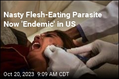 Nasty Flesh-Eating Parasite Now &#39;Endemic&#39; in US
