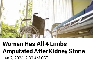 Woman&#39;s Kidney Stone Leads to Quadruple Amputation
