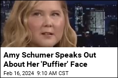 Amy Schumer Pushes Back on Whispers About Her Face