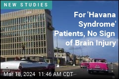 No Brain Injury Seen in &#39;Havana Syndrome&#39; Patients