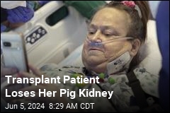 Transplant Patient Loses Her Pig Kidney